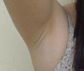 去腋臭的小窍门及日常注意事项