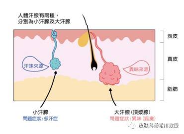 你们关心的狐臭治疗药物和根治手段