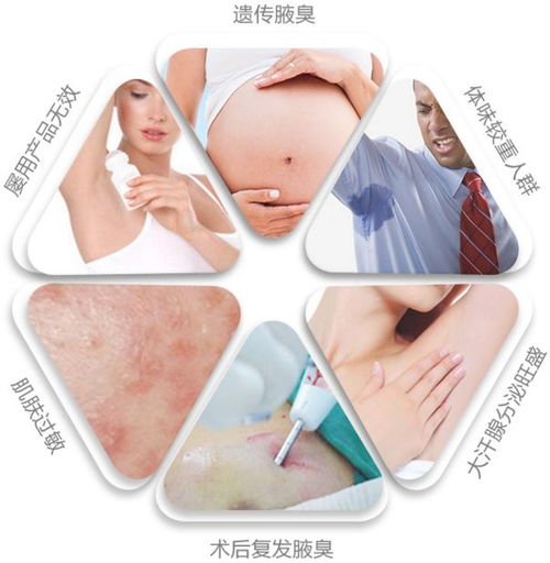 星城精选 还在为体味汗臭狐臭烦恼 新西兰国宝级除味清新液,一喷解决所有体味问题