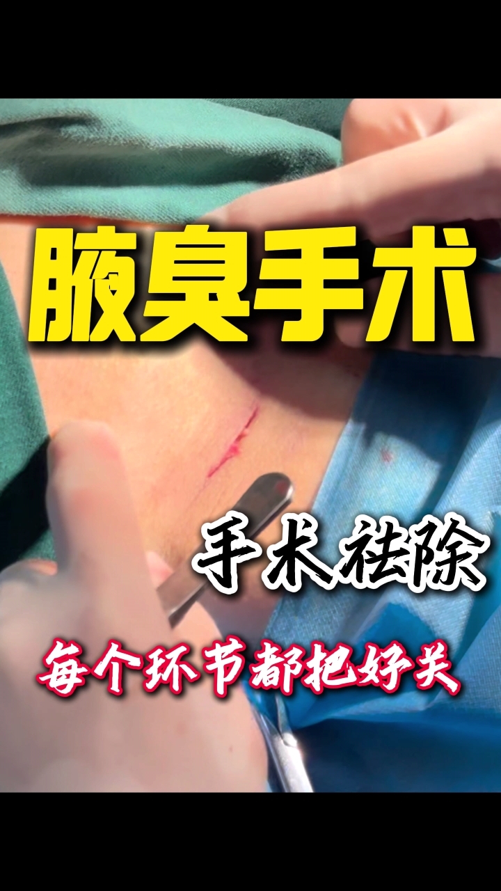 长沙腋臭手术全攻略:术后无痕,自信满满