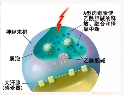 皮肤科:肉毒素治疗腋臭,一“针”助孩子两袖清风